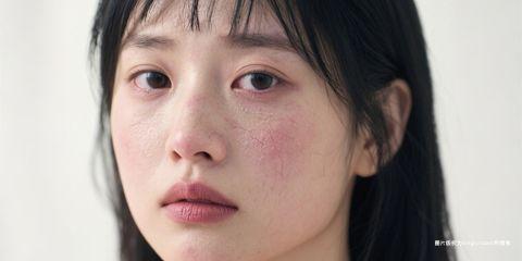 敏感肌肤在日常护理中常面临两大挑战：一方面需要维持 油水平衡，另一方面又必须避免过度刺激。
当屏障功能不稳定时，皮肤容易缺水，同时因补偿作用而增加皮脂分泌，导致外油内干与反覆泛红。
其实，只要掌握正确的保养原则，敏感肌也能稳定达成油水平衡。