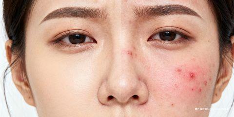 对许多爱美人士而言，化妆是日常自信与仪容的重要一环。然而，敏感肌在面对底妆产品时，往往担心出现红、痒、刺痛或爆痘等反应。其实，只要掌握正确的选择原则与化妆步骤，敏感肌依然可以安心化妆，同时兼顾美观与肌肤健康。本文将从产品挑选、上妆技巧与卸妆护理三方面，解析如何打造不致敏的底妆。