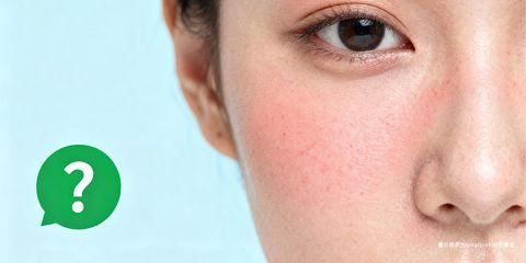 医学美容（Medical Aesthetics）在近年成为许多人改善肤质与延缓老化的重要选项。然而，对于敏感肌人群而言，医美疗程常伴随「能不能做？」的疑虑。由于敏感肌的屏障功能脆弱，若选择不当疗程，可能导致红、痒、脱皮甚至发炎。本文将从专业角度解析敏感肌是否能做医美，以及适合与需避免的疗程建议。