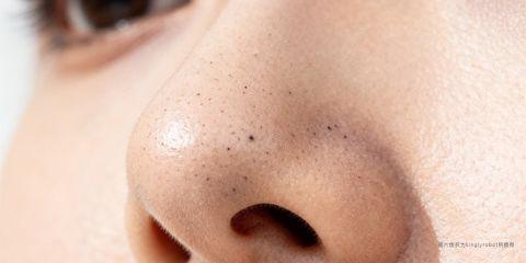 黑头粉刺（Blackheads）是油脂分泌、角质堆积与毛孔氧化作用的结果，常见于鼻翼、额头与下巴。日常清洁不仅能去除表面油脂与污垢，更是预防黑头恶化的基础。然而，错误的洁面产品选择，可能让皮肤屏障受损、刺激皮脂分泌过多，使黑头问题加剧。本文将解析洁面产品挑选的原则，并提供专业建议。