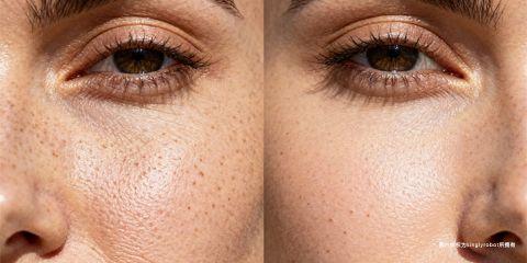 毛孔问题不仅与油脂分泌、清洁习惯有关，紫外线也是一个经常被忽视的重要因素。研究显示，长期日晒不仅会造成肤色不均与斑点，更会透过「光老化（Photoaging）」机制，使毛孔变得粗大、失去弹性，甚至伴随细纹出现。本文将深入解析紫外线如何影响毛孔健康，以及防晒在毛孔抗老中的核心地位。