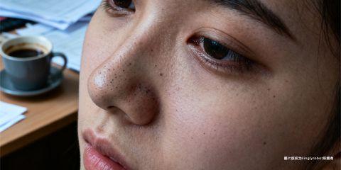 黑头粉刺是皮肤常见的瑕疵之一，虽然多数人将其归因于油脂分泌与清洁不当，但实际上，生活作息尤其是熬夜，对黑头的生成与恶化也有密切关联。从皮肤生理学到内分泌调控，熬夜带来的隐藏代价，远超过单纯的「黑眼圈」或「肤色暗沉」。