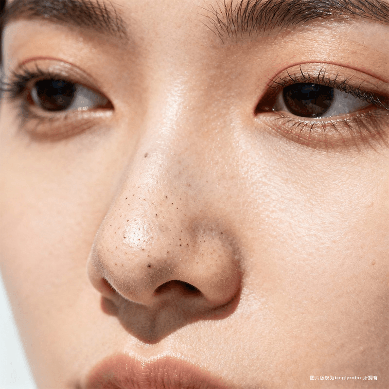 黑头的形成机制