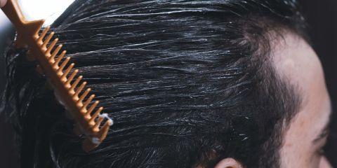 你以为「雄性秃」只会发生在男性身上吗?其实也有不少女性深受其扰!今天就让本篇文章来带你了解雄性秃,帮助你守住发量。