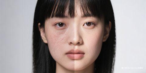 在皮肤科临床中,「油水平衡」与「肌肤屏障」始终是两个密不可分的核心概念。
许多肌肤问题,如干燥、敏感、出油、粉刺与泛红,往往都与这两者失调有关。
从医师的角度来看,想要维持皮肤健康,必须同时注重油水平衡的调整与屏障功能的修护。