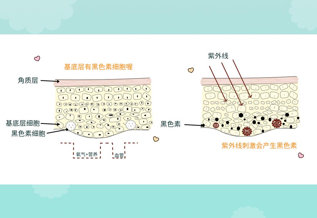 长斑的因素有那些?