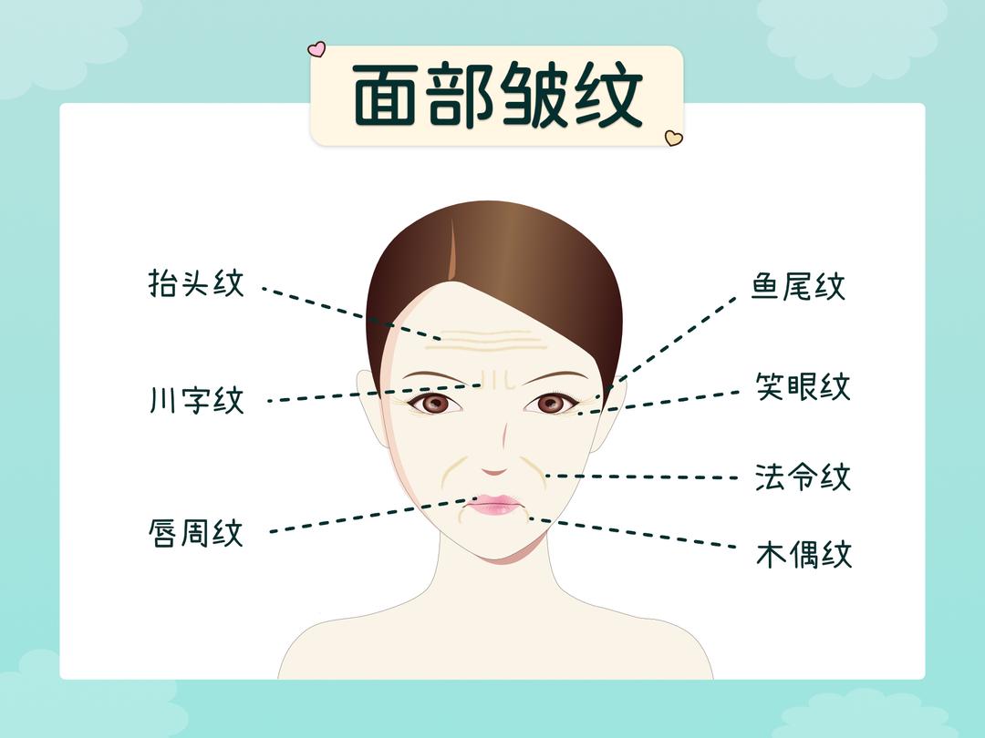 常见皱纹分哪些?