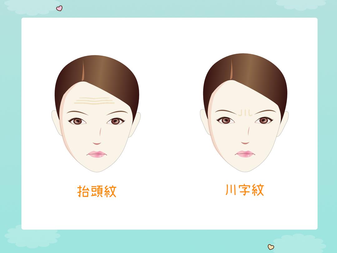 川字纹/眉间纹