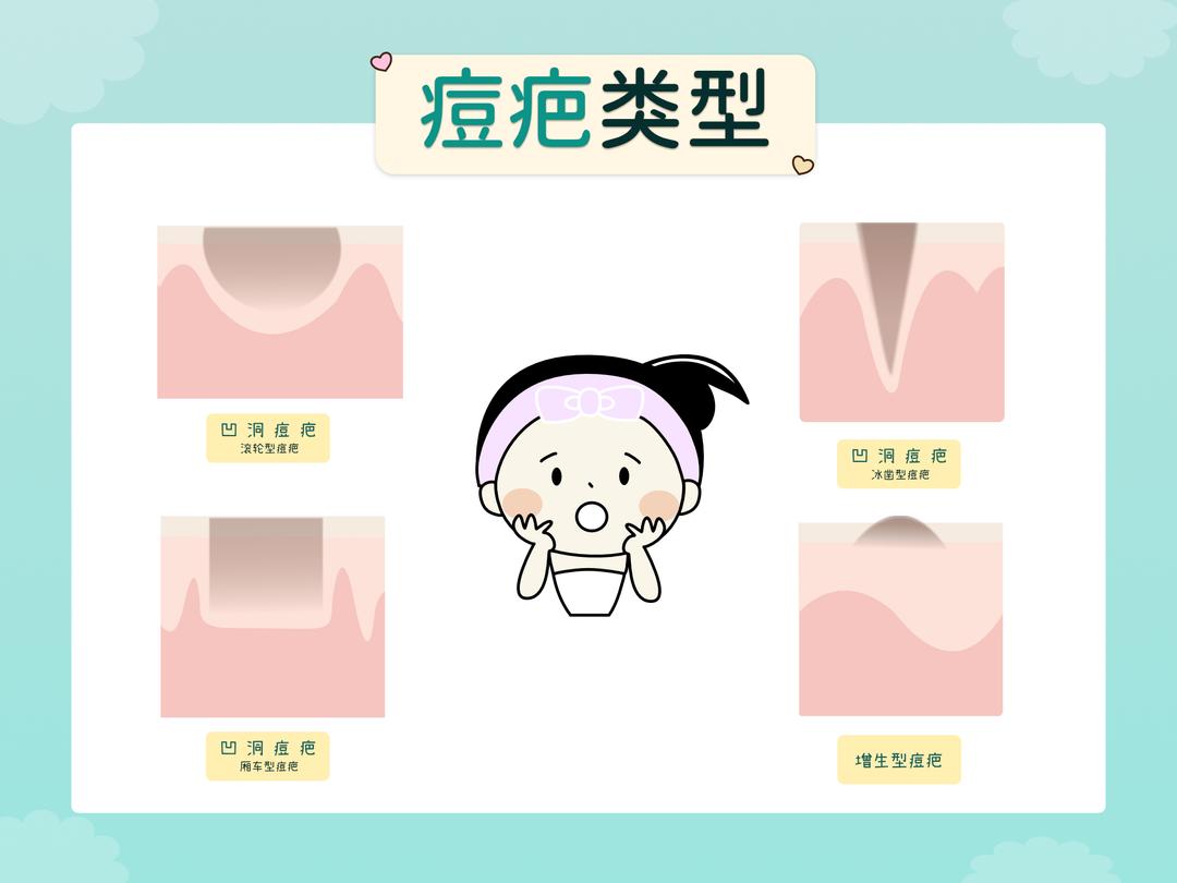 鼻子状况是毛孔粗大还是痘疤