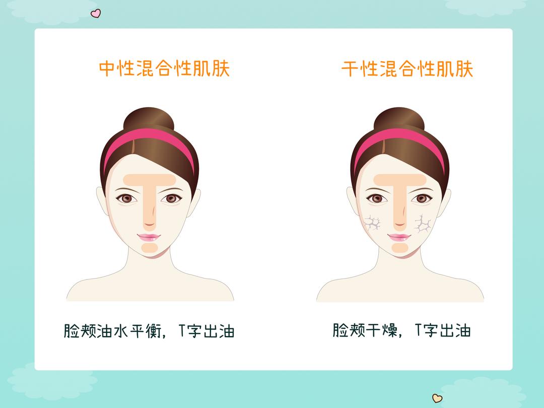 不同肤质的特征