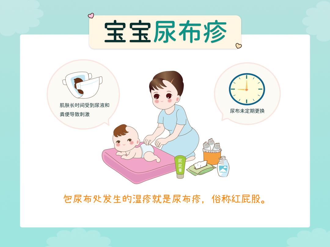 宝宝肌肤问题-尿布疹