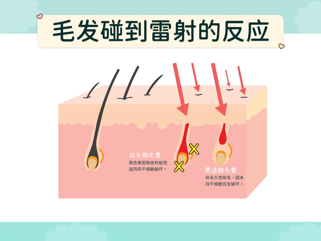 毛发接受到雷射会有什么反应?