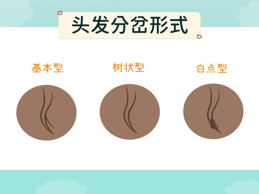 头发为什么会分岔?