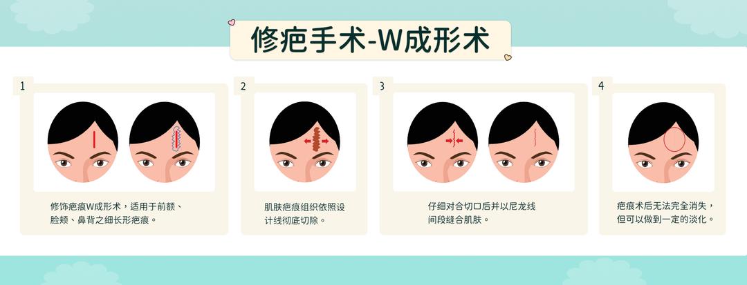 修疤整形手术