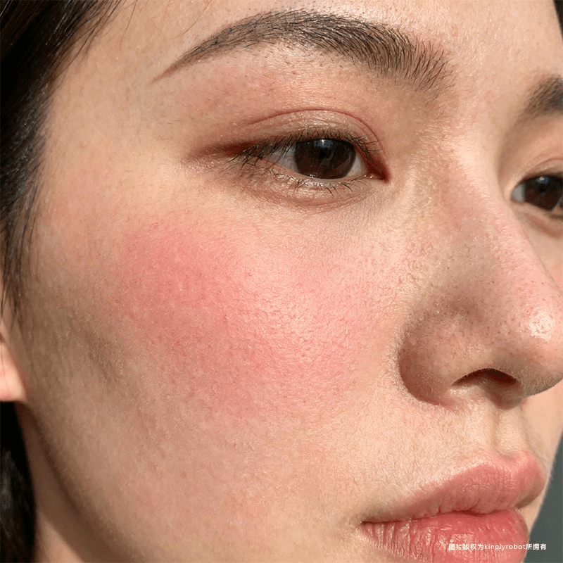 什么是皮肤敏感?