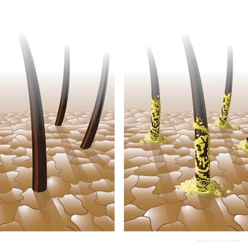 皮脂的来源与组成