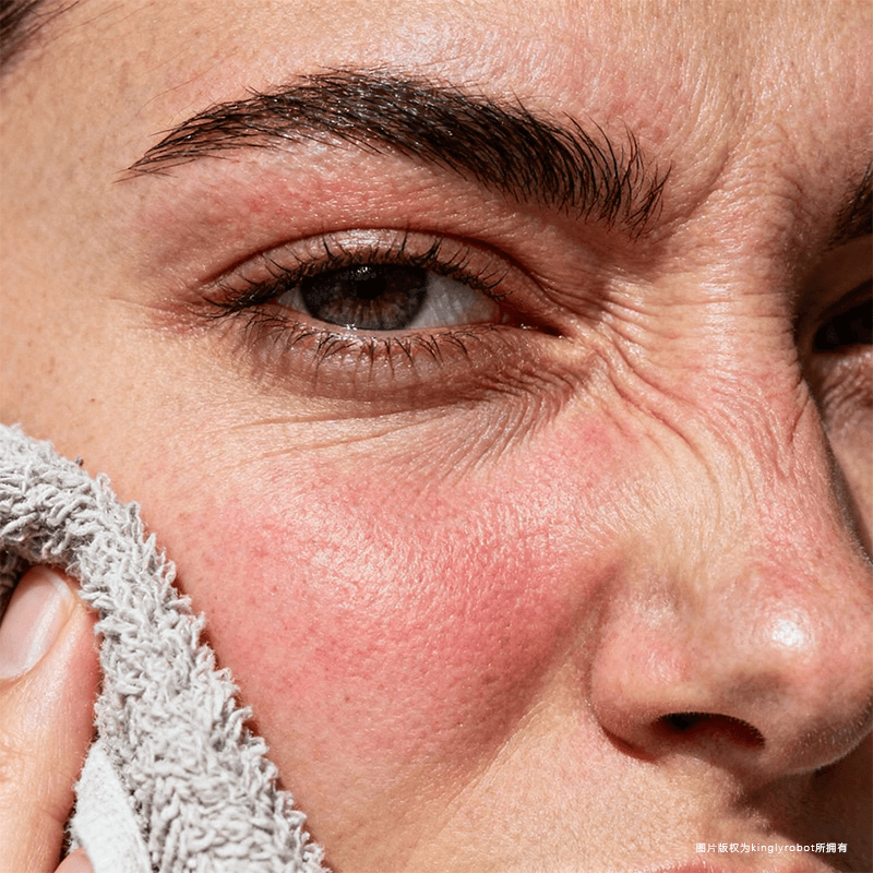 卸妆与清洁不当的常见问题