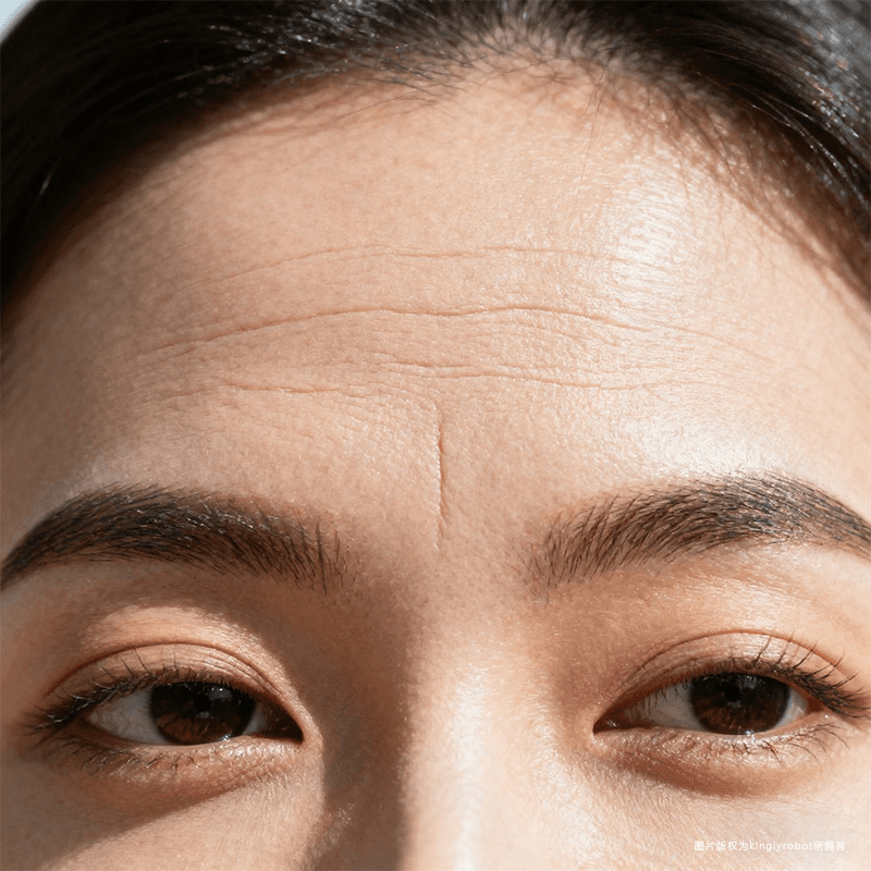 额头细纹:压力与表情的标志